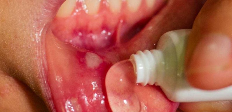 Benign Tumors of the Oral Cavity